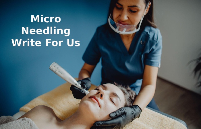Micro Needling Write For Us